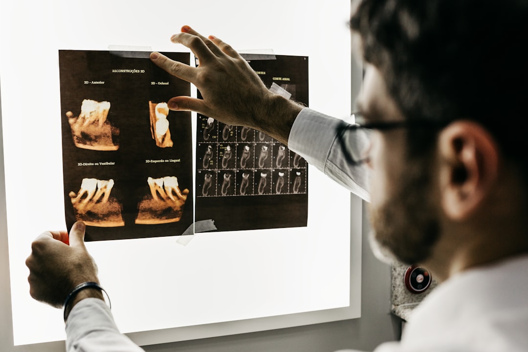 Dentist reviewing dental X-rays — cavities and bone loss show up on film long before symptoms
