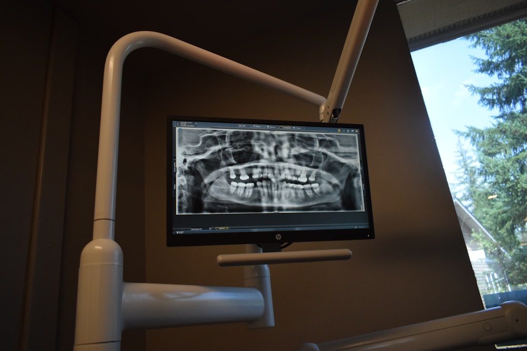 Dental X-ray displayed on a clinic monitor used to diagnose tooth infection
